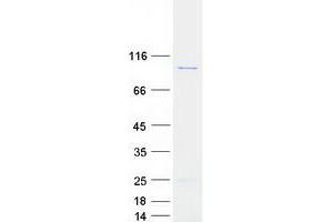 Validation with Western Blot