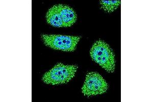 Confocal immunofluorescent analysis of K6 Antibody (Center) (ABIN656098 and ABIN2845441) with U-251MG cell followed by Alexa Fluor 488-conjugated goat anti-rabbit lgG (green). (PAK6 antibody  (AA 268-297))