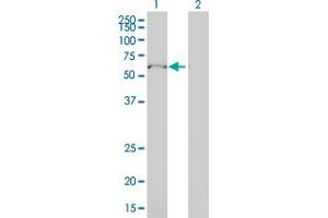 Western Blot analysis of ULK4 expression in transfected 293T cell line by ULK4 monoclonal antibody (M01), clone 4A10-1A7. (ULK4 antibody  (AA 1-580))