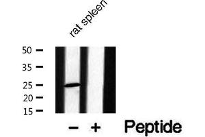 CACNG1 antibody  (Internal Region)