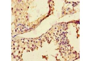 Immunohistochemistry of paraffin-embedded human testis tissue using ABIN7158878 at dilution of 1:100 (MMP12 antibody  (AA 109-470))
