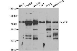 Western Blotting (WB) image for anti-Matrix Metalloproteinase 2 (MMP2) antibody (ABIN1882374) (MMP2 antibody)