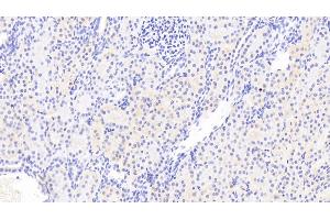 Detection of CSRP1 in Human Kidney Tissue using Polyclonal Antibody to Cysteine And Glycine Rich Protein 1 (CSRP1) (CSRP1 antibody  (AA 1-193))