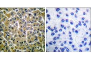Immunohistochemistry (IHC) image for anti-Phospholipase C gamma 2 (PLCG2) (AA 721-770), (pTyr753) antibody (ABIN1531237)