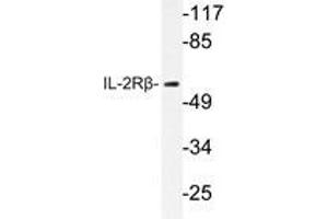 Western blot analysis of IL-2Rβ antibody in extracts from HepG2 cells. (IL2 Receptor beta antibody)