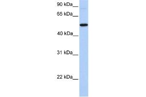 WB Suggested Anti-GALNT13 Antibody Titration:  0. (GALNT13 antibody  (N-Term))