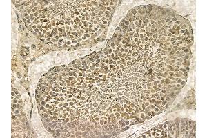 BAHD1 Mouse Monoclonal Antibody at 1/100 staining rat testis tissue by IHC-P.