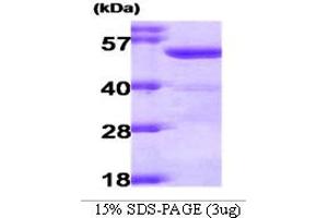 SDS-PAGE (SDS) image for Aldehyde Dehydrogenase 2 Family (Mitochondrial) (ALDH2) (AA 18-517) protein (ABIN666745)