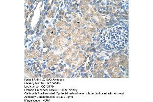 Rabbit Anti-SLC13A3 Antibody  Paraffin Embedded Tissue: Human Kidney Cellular Data: Epithelial cells of renal tubule Antibody Concentration: 4. (SLC13A3 antibody  (Middle Region))