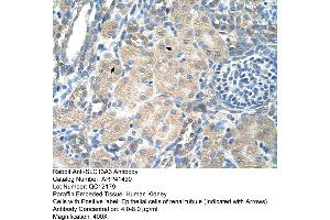 Rabbit Anti-SLC13A3 Antibody  Paraffin Embedded Tissue: Human Kidney Cellular Data: Epithelial cells of renal tubule Antibody Concentration: 4.