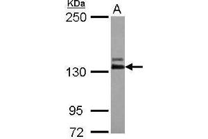 WB Image Sample (30 ug of whole cell lysate) A: IMR32 5% SDS PAGE antibody diluted at 1:1000 (ABL2 antibody  (Center))