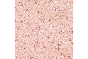 anti-Olfactory Receptor, Family 10, Subfamily H, Member 3 (OR10H3) (AA 1-100) antibody