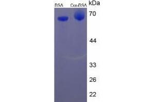 Image no. 2 for Cortisol protein (BSA) (ABIN3201196) (Cortisol Protein (BSA))