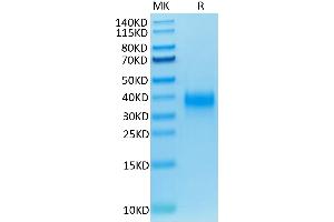 Biotinylated Human CD94 on Tris-Bis PAGE under reduced conditions. (CD94 Protein (AA 34-179) (His-Avi Tag,Biotin))