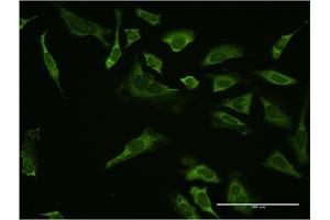 Immunofluorescence of monoclonal antibody to SP1 on HeLa cell. (SP1 antibody  (AA 522-618))