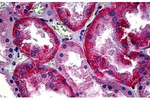 Human Kidney: Formalin-Fixed, Paraffin-Embedded (FFPE) (CD147 antibody)