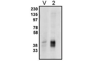 Image no. 1 for anti-Phosphatidic Acid Phosphatase Type 2C (PPAP2C) antibody (ABIN265044) (PPAP2C antibody)