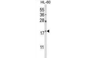 Western Blotting (WB) image for anti-Peptidylprolyl Cis/trans Isomerase, NIMA-Interacting 1 (PIN1) antibody (ABIN3003982) (PIN1 antibody)