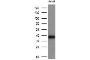 Western Blotting (WB) image for anti-T-cell surface glycoprotein CD1c (CD1C) antibody (ABIN2670676) (CD1c antibody)