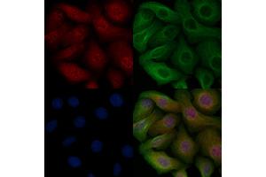 ABIN6255261 and ABIN6267114 staining Heat-shock treated Hela cells by IF/ICC. (EEF2K antibody  (pSer366))