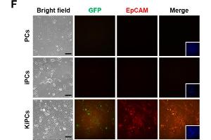 Gene expression analysis of pancreatic-specific markers and pancreatic cancer stem cell markers in KiPCs. (EpCAM antibody  (AA 25-265))