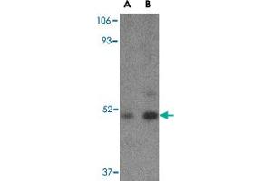 Western blot analysis of TBC1D10C in Daudi cell lysate with TBC1D10C polyclonal antibody  at (A) 1 and (B) 2 ug/mL .