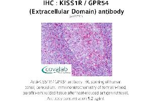Image no. 1 for anti-KISS1 Receptor (KISS1R) (2nd Extracellular Domain) antibody (ABIN1736236) (KISS1R antibody  (2nd Extracellular Domain))