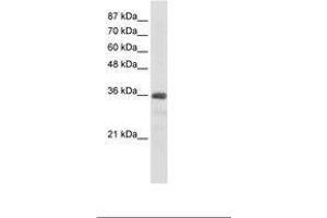 Image no. 2 for anti-U11/U12 SnRNP 35 KDa Protein (AA 29-78) antibody (ABIN203037) (SNRNP35 antibody  (AA 29-78))