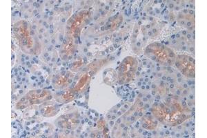 Immunohistochemistry (IHC) image for anti-Ferritin, Mitochondrial (FTMT) (AA 54-229) antibody (ABIN7437572)