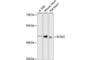 Western blot analysis of extracts of various cell lines, using KCNJ2 antibody (ABIN6129431, ABIN6142727, ABIN6142729 and ABIN6216772) at 1:3000 dilution. (KCNJ2 antibody  (AA 318-427))