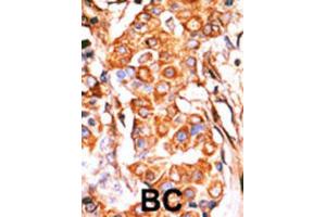 Immunohistochemistry (IHC) image for anti-Glycerol Kinase (GK) antibody (ABIN2995202)
