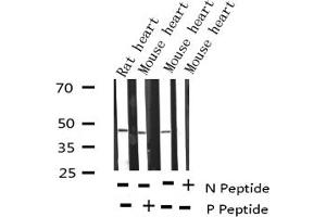 Western Blotting (WB) image for anti-GATA Binding Protein 4 (GATA4) (pSer105) antibody (ABIN6256094)