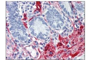 Immunohistochemistry (IHC) image for anti-Filamin A, alpha (FLNA) (AA 1-839) antibody (ABIN782404) (Filamin A antibody  (AA 1-839))