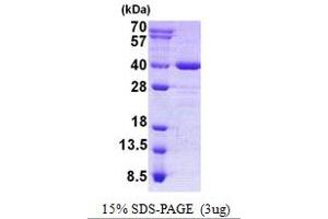 Image no. 1 for Axin Interactor, Dorsalization Associated (AIDA) protein (His tag) (ABIN6387132) (AIDA Protein (His tag))