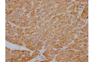 IHC image of ABIN7180354 diluted at 1:100 and staining in paraffin-embedded human heart tissue performed on a Leica BondTM system. (beta Actin antibody)