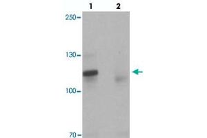 Western blot analysis of TSHZ3 in mouse brain tissue with TSHZ3 polyclonal antibody  at 1 ug/mL in (lane 1) the absence and (lane 2) the presence of blocking peptide. (TSHZ3 antibody  (N-Term))
