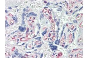 Immunohistochemistry (IHC) image for anti-Caspase 7, Apoptosis-Related Cysteine Peptidase (CASP7) antibody (ABIN614356) (Caspase 7 antibody)