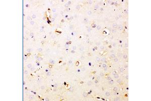 Anti- DHFR Picoband antibody,IHC(P) IHC(P): Rat Brain Tissue (Dihydrofolate Reductase antibody  (AA 2-187))