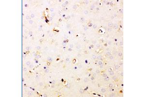 Anti- DHFR Picoband antibody,IHC(P) IHC(P): Rat Brain Tissue
