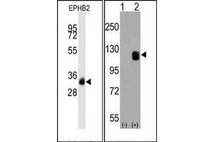 Western Blotting (WB) image for anti-EPH Receptor B2 (EPHB2) antibody (ABIN356401) (EPH Receptor B2 antibody)