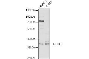 Western blot analysis of extracts of various cell lines, using KCNK15 antibody (ABIN7269466) at 1:1000 dilution. (KCNK15 antibody  (AA 200-300))