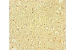 Immunohistochemistry of paraffin-embedded human brain tissue using ABIN7155318 at dilution of 1:100 (HDAC5 antibody  (AA 1-100))