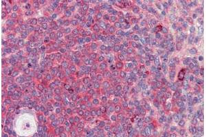 Immunohistochemistry (Paraffin-embedded Sections) (IHC (p)) image for anti-BTB and CNC Homology 1, Basic Leucine Zipper Transcription Factor 2 (BACH2) (C-Term) antibody (ABIN6741581)