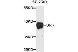 Western blot analysis of extracts of rat brain cells, using SRR antibody. (SRR antibody)
