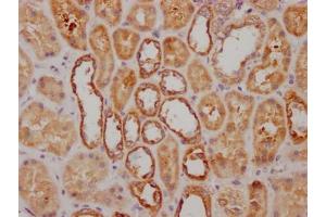 IHC image of ABIN7127638 diluted at 1:100 and staining in paraffin-embedded human kidney tissue performed on a Leica BondTM system. (Recombinant NDUFS3 antibody)