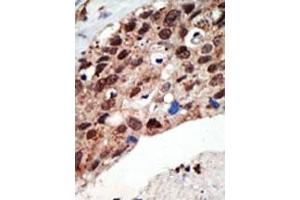 Image no. 1 for anti-SET Domain Containing (Lysine Methyltransferase) 7 (SETD7) (Middle Region) antibody (ABIN356694) (SETD7 antibody  (Middle Region))