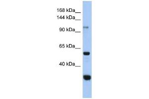 GANC antibody used at 1 ug/ml to detect target protein. (GANC antibody  (Middle Region))