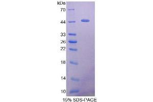 SDS-PAGE (SDS) image for tau Protein (AA 34-368) protein (His tag) (ABIN1879215) (tau Protein (AA 34-368) (His tag))