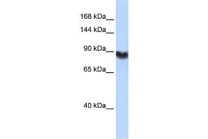 WB Suggested Anti-LIG1 Antibody Titration: 0. (LIG1 antibody  (Middle Region))