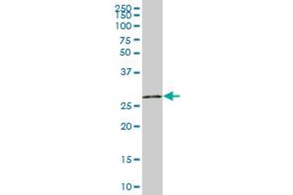 UNG antibody  (AA 1-304)